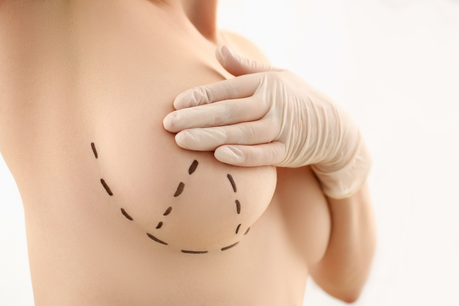 Forget silicone, now there's a breast lift on the inside - ISRAEL21c